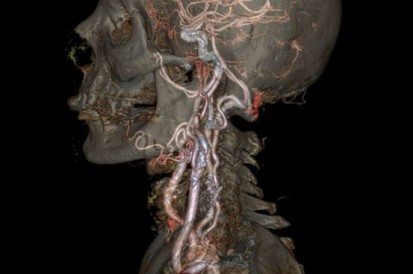 ComplexeCarotis-hals-anatomie